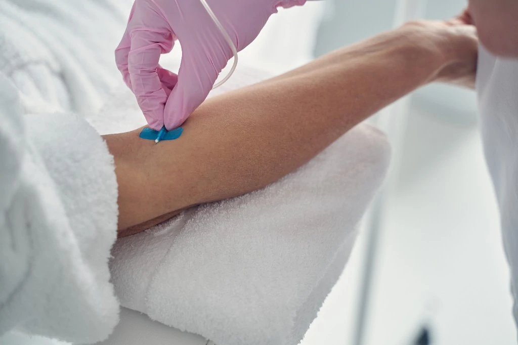 静脈内鎮静法
