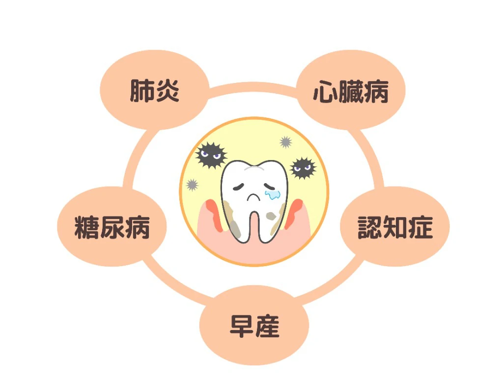 全身の健康と歯周病の関係